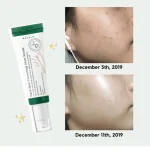 سرم ضد لک دارک اسپات اکسیس وای حجم 50میلی لیتر - تصویر 4