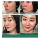 سرم پیلینگ AHA 30% + BHA 2% اوردینری حجم 30 میلی لیتر - تصویر 7