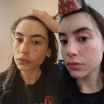 سرم نیاسینامید ۱۵ کوزارکس حجم 20 میلی لیتر - تصویر 2