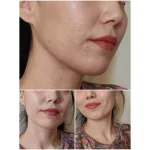 ضد آفتاب فتودرم آکنه مت بایودرما SPF30 - تصویر 3